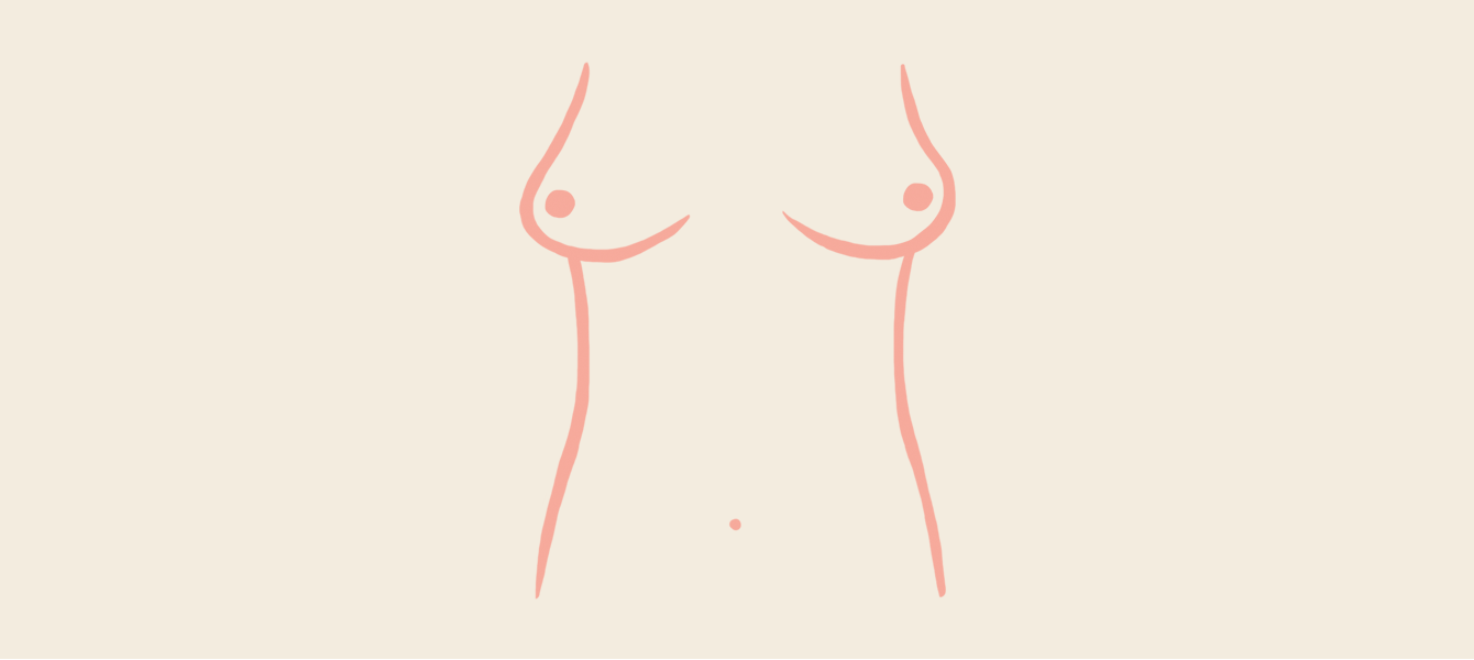 Understanding East-West Breasts: Common Questions Answered - Front